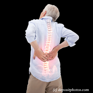 image Baton Rouge back pain with lumbar spinal stenosis